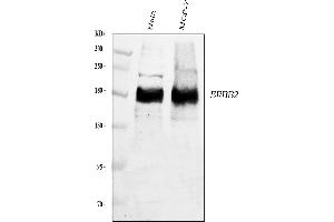 Western blot analysis of ErbB 2 using anti-ErbB 2 antibody (ABIN5518830).