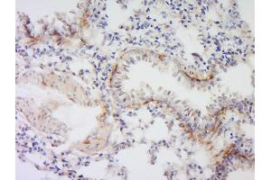 Formalin-fixed and paraffin embedded rat lung labeled with Anti- VSIG4 Polyclonal Antibody, Unconjugated  at 1:300 followed by conjugation to the secondary antibody and DAB staining. (VSIG4 antibody  (AA 81-160))
