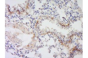 Formalin-fixed and paraffin embedded rat lung labeled with Anti- VSIG4 Polyclonal Antibody, Unconjugated  at 1:300 followed by conjugation to the secondary antibody and DAB staining.