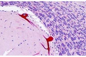 Human Brain, Cerebellum: Formalin-Fixed, Paraffin-Embedded (FFPE) (DAB1 antibody  (AA 187-236))