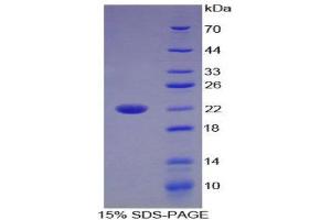 SDS-PAGE (SDS) image for Interleukin 17B (IL17B) (AA 21-180) protein (His tag) (ABIN2125458)