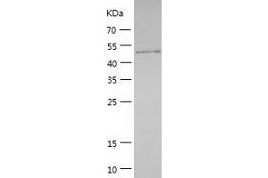 Western Blotting (WB) image for Protein Phosphatase 1F (PP2C Domain Containing) (PPM1F) (AA 1-454) protein (His tag) (ABIN7286282) (PPM1F Protein (AA 1-454) (His tag))