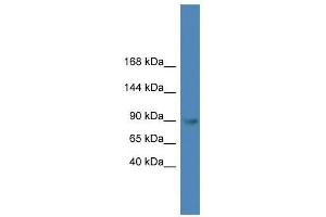 TLR4 antibody used at 0. (TLR4 antibody  (C-Term))