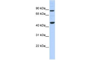 WB Suggested Anti-PPME1 Antibody Titration: 0. (PPME1 antibody  (N-Term))