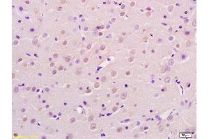 Formalin-fixed and paraffin embedded rat brain labeled with Rabbit Anti AP2 gamma Polyclonal Antibody, Unconjugated (ABIN720056) at 1:200 followed by conjugation to the secondary antibody and DAB staining (TFAP2C antibody  (AA 2-100))