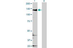 Western Blot analysis of CYFIP2 expression in transfected 293T cell line by CYFIP2 monoclonal antibody (M01), clone 4G6.