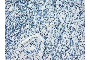 Immunohistochemical staining of paraffin-embedded colon tissue using anti-ZFP36 mouse monoclonal antibody. (ZFP36 antibody)