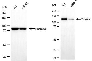 Western blotting analysis using Vinculin antibody (ABIN7800842). (Recombinant Vinculin antibody)