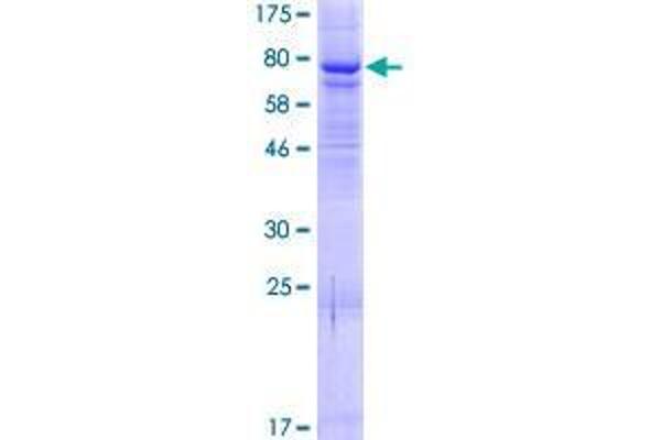 ELP4 Protein (AA 1-535) (GST tag)