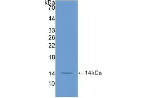 Detection of Recombinant F7, Human using Monoclonal Antibody to Coagulation Factor VII (F7) (Factor VII antibody  (AA 334-452))