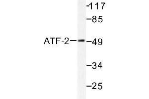 Image no. 1 for anti-Activating Transcription Factor 2 (ATF2) antibody (ABIN265320) (ATF2 antibody)