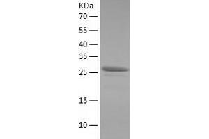 TTC1 Protein (AA 1-292) (His tag)