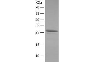 Western Blotting (WB) image for Tetratricopeptide Repeat Domain 1 (TTC1) (AA 1-292) protein (His tag) (ABIN7125340) (TTC1 Protein (AA 1-292) (His tag))
