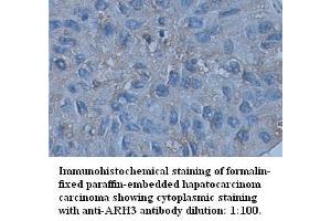 Image no. 1 for anti-ADP-Ribosylhydrolase Like 2 (ADPRHL2) (C-Term) antibody (ABIN791068) (ADPRHL2 antibody  (C-Term))