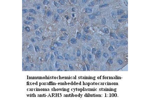 ADPRHL2 antibody  (C-Term)