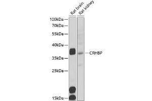Western blot analysis of extracts of various cell lines, using CRHBP antibody (ABIN6129571, ABIN6139030, ABIN6139033 and ABIN6222243) at 1:1000 dilution. (CRHBP antibody  (AA 25-322))