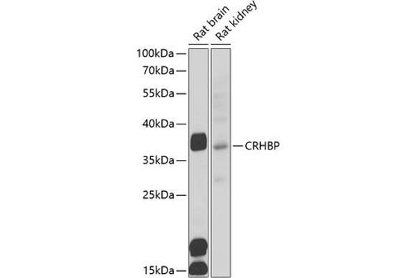 CRHBP antibody  (AA 25-322)