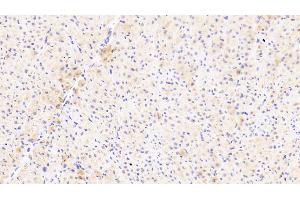 Detection of PARC in Human Cardiac Muscle Tissue using Polyclonal Antibody to Pulmonary Activation Regulated Chemokine (PARC) (CCL18 antibody  (AA 21-89))