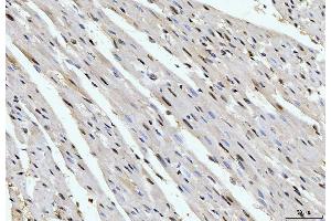 IHC analysis of Cyclophilin E/PPIE using anti-Cyclophilin E/PPIE antibody (ABIN7599242). (PPIE antibody  (AA 1-301))
