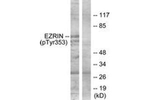Western blot analysis of extracts from A431 cells treated with EGF 200ng/ml 30', using Ezrin (Phospho-Tyr353) Antibody. (Ezrin antibody  (pTyr354))