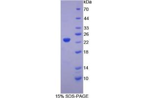 SDS-PAGE analysis of Chicken Hemoglobin beta Protein.