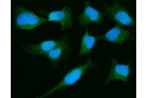 IF analysis of PARK7/DJ1 using anti-PARK7/DJ1 antibody (ABIN7600468). (PARK7/DJ1 antibody  (AA 2-189))