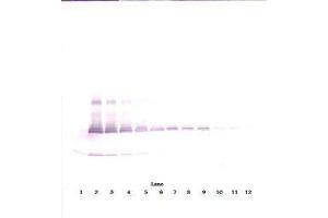 Image no. 3 for anti-Interleukin 17A (IL17A) antibody (ABIN465354) (Interleukin 17a antibody)