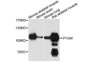 Western blot analysis of extracts of various cell lines, using PYGM antibody.