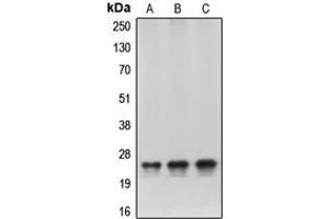 Western blot analysis of HP1 alpha expression in HeLa (A), NIH3T3 (B), C6 (C) whole cell lysates. (CBX5 antibody  (Center))