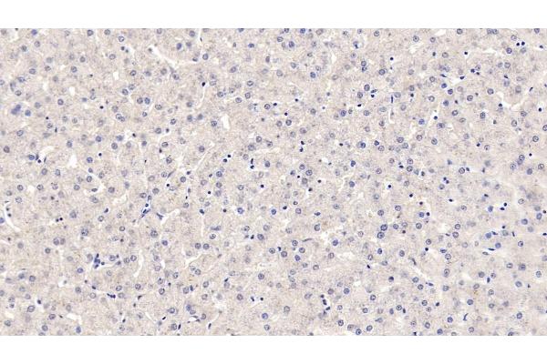 ROS1 antibody  (AA 1945-2222)