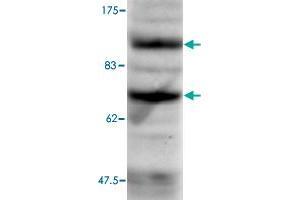 B. (ASH2L antibody)