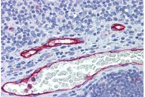 Human Thymus, Vessels: Formalin-Fixed, Paraffin-Embedded (FFPE) (DARC antibody  (AA 1-50))