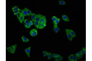Immunofluorescence staining of HepG2 cells with ABIN7170083 at 1:166, counter-stained with DAPI. (KCC2 antibody  (AA 944-1071))