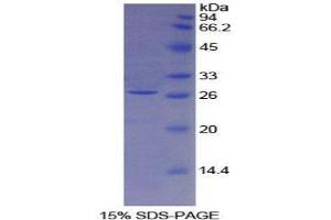SDS-PAGE (SDS) image for Coagulation Factor III (thromboplastin, Tissue Factor) (F3) (AA 30-251) protein (His tag) (ABIN1080933) (Tissue factor Protein (AA 30-251) (His tag))