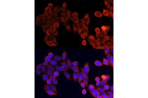 Immunofluorescence analysis of HeLa cells using MTOR antibody. (MTOR antibody)