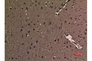 Immunohistochemistry (IHC) image for anti-Tumor Protein P53 (TP53) (2meLys370) antibody (ABIN3181859)