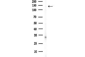 Western blot analysis of lysates from MDA-MB-231 cells(heat-shock,45 min treatment), using KIF4B Antibody at 1/1000 dilution.