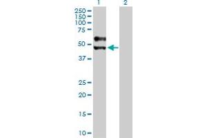 Western Blot analysis of SIGIRR expression in transfected 293T cell line by SIGIRR MaxPab polyclonal antibody. (SIGIRR antibody  (AA 1-410))