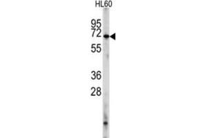 Western Blotting (WB) image for anti-phosphodiesterase 8A (PDE8A) antibody (ABIN2998130)