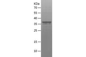 Western Blotting (WB) image for CD8a Molecule (CD8A) (AA 22-182) protein (His-IF2DI Tag) (ABIN7283432) (CD8 alpha Protein (AA 22-182) (His-IF2DI Tag))