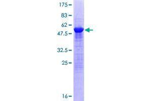 SAMD4A Protein (AA 1-247) (GST tag)