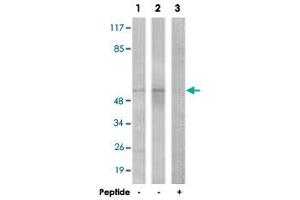 Western blot analysis of extracts from COLO cells (Lane 1) and HepG2 cells (Lane 2 and 3), using TGFBR1 polyclonal antibody . (TGFBR1 antibody  (Ser165))