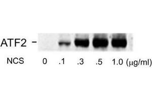 Image no. 1 for anti-Activating Transcription Factor 2 (ATF2) (pSer490), (pSer498) antibody (ABIN372591) (ATF2 antibody  (pSer490, pSer498))