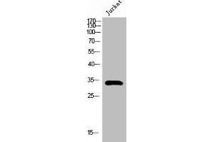 Western Blot analysis of Jurkat cells using Pitx1 Polyclonal Antibody (PITX1 antibody  (Internal Region))