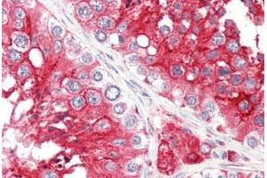 Human Testis (formalin-fixed, paraffin-embedded) stained with ACE2 antibody ABIN461888 at 2. (ACE2 antibody  (Internal Region))