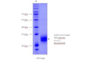 Size, purity and oligomerization state of CoV-2 spike protein RBD domain assessed by SDS-PAGE.