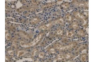 Immunohistochemistry (IHC) image for anti-Apolipoprotein B (APOB) (AA 2747-2913) antibody (ABIN7429130)