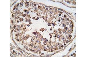 IHC analysis of FFPE human testis tissue stained with TBK antibody (TBK1 antibody  (AA 150-181))