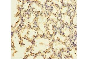 Immunohistochemistry of paraffin-embedded human lung tissue using ABIN7176105 at dilution of 1:100 (ZNF114 antibody  (AA 1-414))