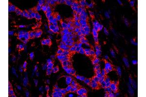 Immunofluorescence (IF) image for anti-Ubiquitin Specific Peptidase 3 (USP3) (AA 471-521) antibody (ABIN7449030) (USP3 antibody  (AA 471-521))